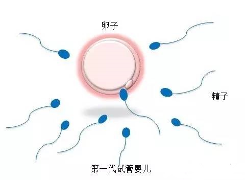 高龄二胎案例
